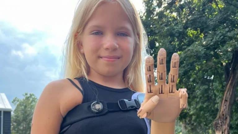 Charitable organization Siemens allocated $250,000 to provide free bionic prostheses to Ukrainians